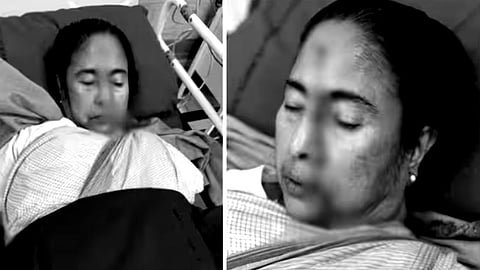 மம்தா பானர்ஜி காயம்