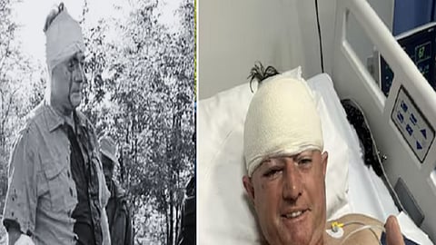 சிறுத்தை தாக்கப்பட்ட போதும், சிகிச்சைக்கு பின்னும் கய் விட்டல்