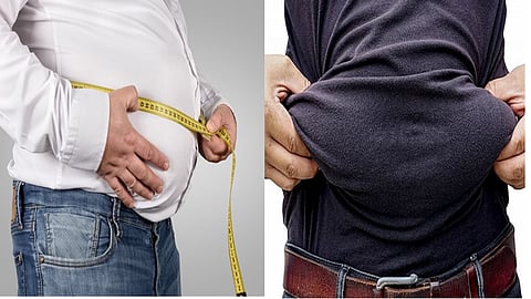 உடல் பருமன்