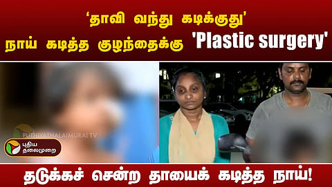 அண்ணா நகர் - நாய்க்கடிக்கு உள்ளான சிறுமி