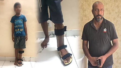 பாதிக்கப்பட்ட குழந்தை