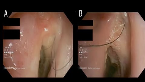 ஆஸ்திரேலியா