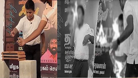 விஜய் பிறந்தநாள் விழாவில் சிறுவனுக்கு தீவிபத்து