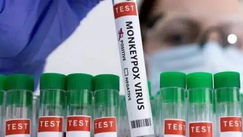 குரங்கம்மை