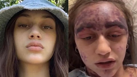 அலெக்சிஸ் லோரன்ஸ்