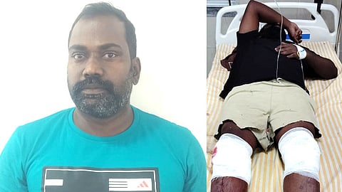 ஆல்வின்