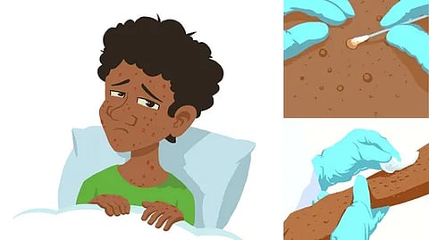 கிளேட் 1பி