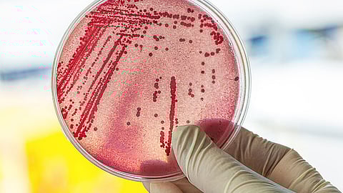 ஆய்வு சோதனை