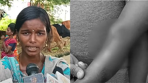 பாதிக்கப்பட்ட குழந்தையின் தாய்