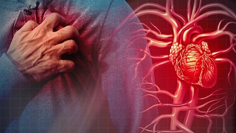 மாரடைப்பு