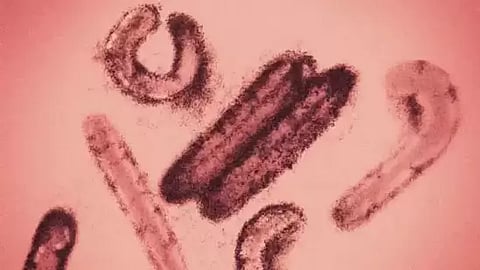 ரத்தப்போக்கு கண் வைரஸ்