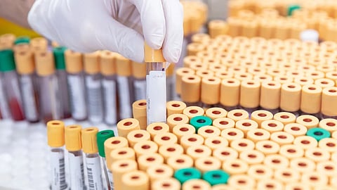 ஆஸ்திரேலியா