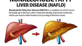 கல்லீரல் படம்