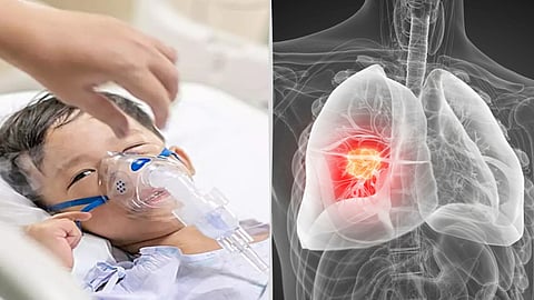 வாக்கிங் நிமோனியா