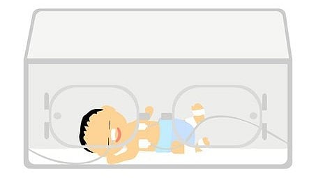 குழந்தைக்கு செயற்கை சுவாசம்