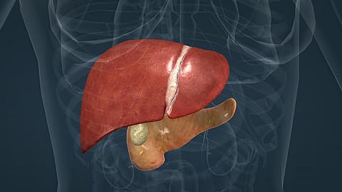 a full details of non alcoholic fatty liver disease