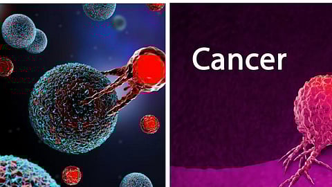 கேன்சர் சிகிச்சை முறை