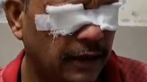 punjab over 65 suffer eye irritation after applying solution for hair loss