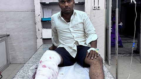 ஆட்டோ ஓட்டுநரை சுட்டுப் பிடித்த காவல்துறை