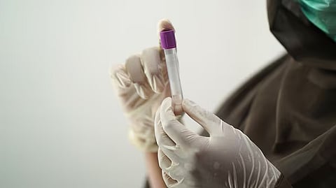 russia mystery virus outbreak reports