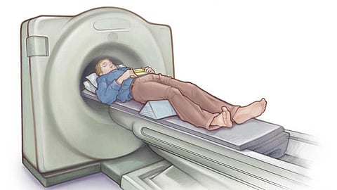 சிடி ஸ்கேன்