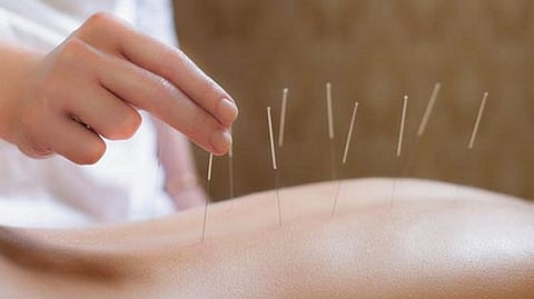 Illegal Acupuncture Chinese Man In ICU admitted
