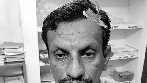 காவல் ஆய்வாளர் மீது கல்வீசி தாக்கு