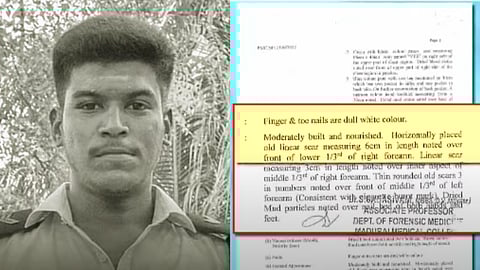 அஜித் குமார், உடற்கூராய்வு அறிக்கை