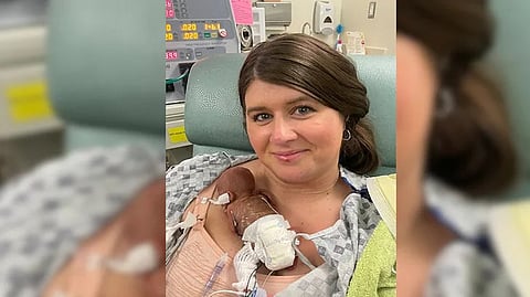 உலகிலேயே மிக குறைந்தகால பிரசவத்தில் பிறந்த குழந்தை