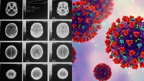 COVID-19 Pandemic - brain faster