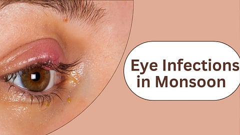 tips for Eye Infections During Raining time Do’s And Don’ts