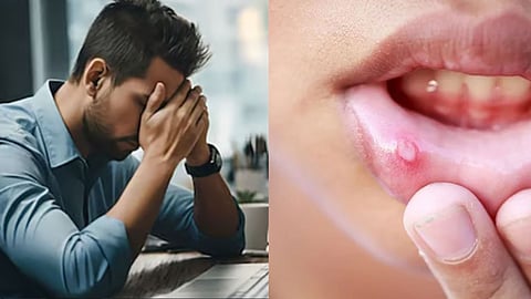 வாய்ப்புற்று நோய்