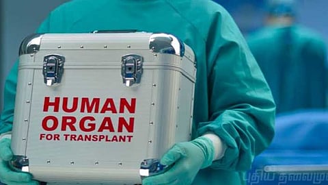 organ transplant