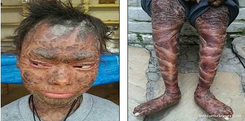 பாம்பாக மாறிவரும் 16 வயது பெண்.. பள்ளியிலிருந்து நீக்கப்பட்ட கொடுமை...!