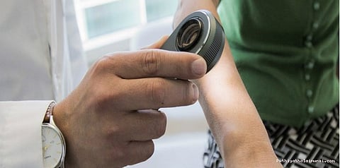 தோல் புற்றுநோயை இனி தானாகவே கண்டறியலாம்..!