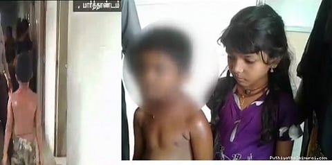 1ம் வகுப்பு மாணவனை கடுமையாக தாக்கிய ஆசிரியை