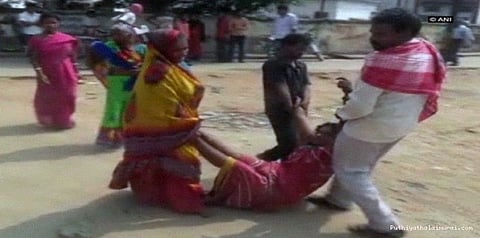 ஸ்ட்ரெச்சர் இல்லை என்பதற்காக இப்படியா செய்வாங்க?