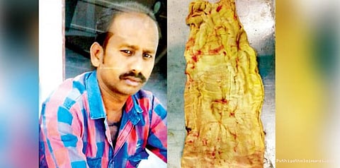 அட அப்ரண்டீஸ்களா, இப்படியா பண்ணுவீங்க ஆபரேஷனை!