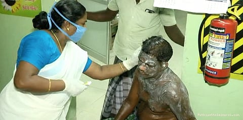 எப்ப பாரு போதை: கொதிக்கும் எண்ணெயை ஊற்றினார் மனைவி