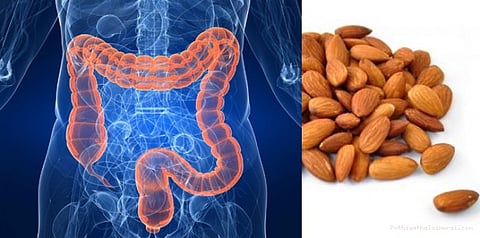 பாதாம் பருப்பு சாப்பிட்டால் குடல் புற்றுநோய் பரவுவது தடுக்கப்படும்