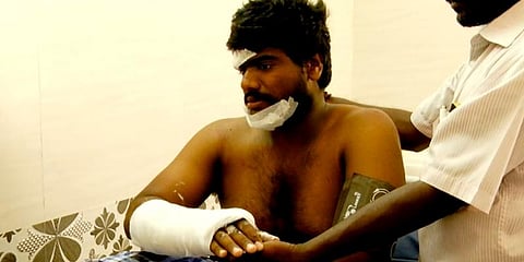 வெடித்தது ஆப்பிள்! இளைஞர் காயம்