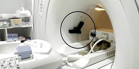 எம்.ஆர்.ஐ. ஸ்கேன் இயந்திரத்தை பாழாக்கிய அமைச்சரின் துப்பாக்கி