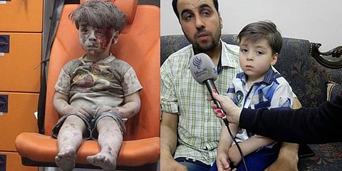 அலேப்போ தாக்குதலில் பாதிக்கப்பட்ட சிறுவனின் புதிய புகைப்படம்