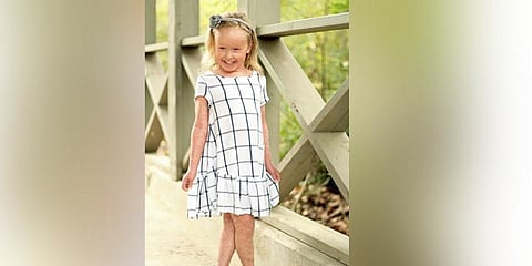 தோல் உதிரும் நோயால் அவதிப்படும் குழந்தை