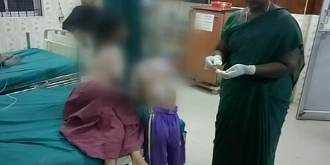 குழந்தைகளுக்கு சூடுவைத்து கொடுமைப்படுத்திய தாய்