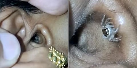 'பெண்ணின் காதிற்குள் நுழைந்த சிலந்தி'