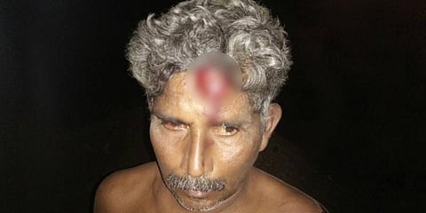 தமிழக அரசு வாகனங்கள் மீது பசு பாதுகாப்பு கும்பல் தாக்குதல்: டிரைவர் மண்டை உடைப்பு