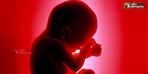 கருவை கலைக்க அனுமதி அளித்த உச்சநீதிமன்றம்