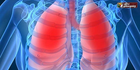 5 நாடுகளில் மட்டும் நுரையீரல் தொற்றால் 1 லட்சம் குழந்தைகள் மரணம்