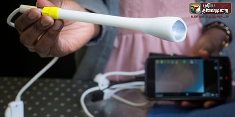 மருத்துவமனை செல்லாமலே புற்றுநோயை கண்டுபிடிக்கும் கருவி